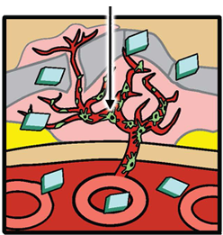 Diagram 3 - Rationale for Combination Therapy