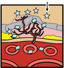 Diagram 4 - Rationale for Combination Therapy